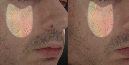 Skin texture heat map comparison
